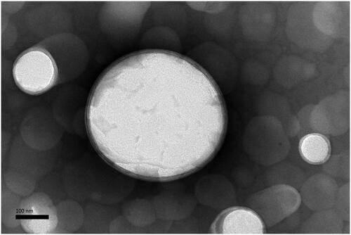 Figure 1. Transmission electron microscope (TEM) micrographs of the anti-DEC-205-OVA-EUPS-LPSM, SMP (50,000×).