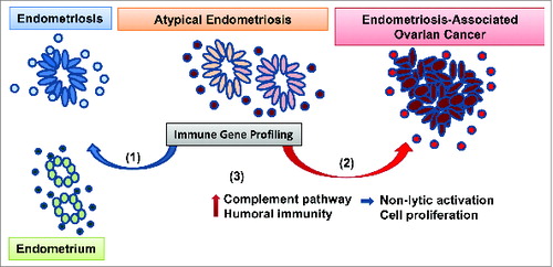 Figure 1. Approach to profiling immune dysregulation in endometriosis and ovarian cancer. Endometrioid, clear cell and low grade serous ovarian tumors may develop from endometriosis, a chronic benign inflammatory condition consisting of endometrial-like epithelial glands (ovals) surrounded by immune stroma (circles). Atypical endometriosis (defined by morphological criteria) is considered to be the immediate cancer precursor. We recently profiled the immune microenvironment in normal endometrium, benign and atypical endometriosis and endometriosis-associated ovarian cancer (EAOC). Our results show that (1) while some of the atypical endometriosis cases have signs of benign inflammation (blue arrow), (2) 85% of cases have a cancerlike immune gene signature (red arrow). (3) Pathway analyses revealed complement activation and humoral immunity in endometriosis and EAOC. In parallel, mechanistic studies in ovarian cells from genetically engineered mice show that complement upregulation in epithelial cells does not trigger antibody-induced and complement-mediated cytotoxicity. Moreover, downregulation of complement inhibits tumor cell proliferation.
