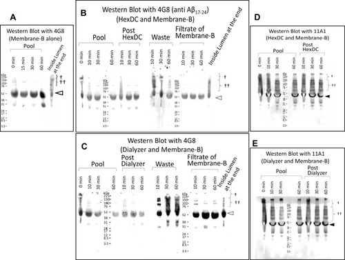 Figure 8 Preliminary Western blot analysis of the plasma treated using the Aβ oligomer removal system in vitro.The plasma treated with the Aβ oligomer removal system in vitro was investigated by Western blot analysis following electrophoresis of reduced SDS-PAGE results. (A–C) Proved with anti-Aβ17–24 antibody 4G8. (D, E) Proved with 11A1 (anti-human amyloid β E22P of Aβ10–35, toxic oligomers of Aβ with a turn at positions 22 and 23). (A) Plasma in Pool at zero, 15, 30, and 60 min of circulation and Inside-Lumen at the end of circulation treated with Membrane B alone. (B) Plasma in Pool at zero, 10, 30, and 60 min circulation; in the post-HexDC stage, in waste and in the filtrate of Membrane B at 10, 30, and 60 min and in Inside-Lumen at the end of treatment with Membrane B and HexDC. Sampling positions are shown in Figure 4. (C) Plasma in Pool at zero, 10, 30, and 60 min of circulation; in the post-dialyzer stage, in waste and in the filtrate of Membrane B at 10, 30, and 60 min and in Inside-Lumen at the end of treatment with Membrane B and polysulfone hemodialyzers. Sampling positions are shown in Figure 5. (D) Plasma in Pool at zero, 10, 30, and 60 min circulation, in the post-HexDC stage at 10, 30, and 60 min treated with Membrane B and HexDC. (E) Plasma in Pool at zero, 10, 30, and 60 min and in the post-dialyzer stage at 10, 30, and 60 min treated with Membrane B and hemodialyzers. †, >150 kDa Aβ oligomer-like bands; ††, 70–150 kDa Aβ oligomer-like bands. The bands that migrate at ~57 kDa bands that are detected with antibody 4G8 (open triangles) are non-specific.Citation37 Bands migrating at ~40–50 kDa were detected with antibody 11A1 (closed triangles).