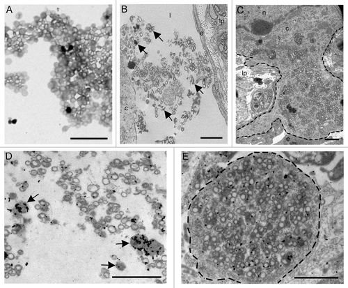 Figure 4. (A) Electron microscopy on the preparation containing rPrP demonstrated circular membrane profiles of unconfirmed origins in addition to electron dense amorphous material. (B and C) After inoculation into intestinal loops, electron dense amorphous material and circular structures were observed non-cell-associated in the lacteals (arrows) (B) and in the cytoplasm of a mononuclear cell (delineated) (C). Immunogold labeling showed rPrP labeling of inconspicuous electron dense amorphous aggregates (arrows) and on membranes of circular profiles in a lacteal (D) and in the cytoplasm of a mononuclear cell (delineated) (E). Scale bars, 1 µm. (l) lacteal, (lp) lamina propria, (e) endothelial cell, (c) cytoplasm, (n) nucleus.