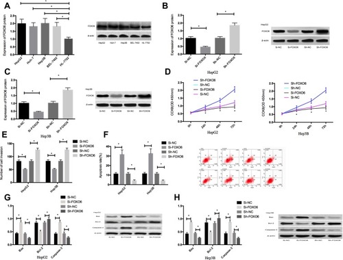 Figure 2 Effects of FOXO6 on proliferation, invasion and apoptosis of HCC cells. (A) FOXO6 expression in HCC cells. (B) FOXO6 expression in transfected HepG2 cells. (C) FOXO6 expression in transfected Hep3B cells. (D) Proliferation ability of transfected HepG2 and Hep3B cells. (E) Invasion ability of transfected HepG2 and Hep3B cells. (F) Apoptosis rates of transfected HepG2 and Hep3B cells. (G) Expression of apoptosis-related proteins in transfected HepG2 cells. (H) Expression of apoptosis-related proteins in transfected Hep3B cells. *Indicates P<0.05.