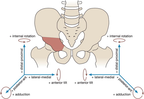 Figure 21. The pelvis and axes of rotation and translation of the acetabular fragment (brown area).