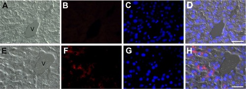 Figure 5 Light microscopy images of liver sections from control (A–D) and SLN-CG/RH-treated (E–H) mice. (A, E) brightfield images; (B, F) red signal from RH contained in SLN; (C, G) blue signal from DNA stained with Hoechst; (D, H) merge of brightfield image, red and blue fluorescence. Note the red fluorescence signal inside the hepatocytes of the treated mouse. V: centrilobular vein. Bars 50 µm.