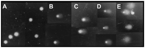 Figure 5 Representative images (at ×40 magnification) illustrating the tail intensity for the fibroblast comet test scores.Notes: (A) score = 0 (negative control); (B) score = 1 (nanofibers); (C) score = 2 (nanofibers); (D) score = 3 (nanofibers); (E) score = 4 (nanofibers and positive control).