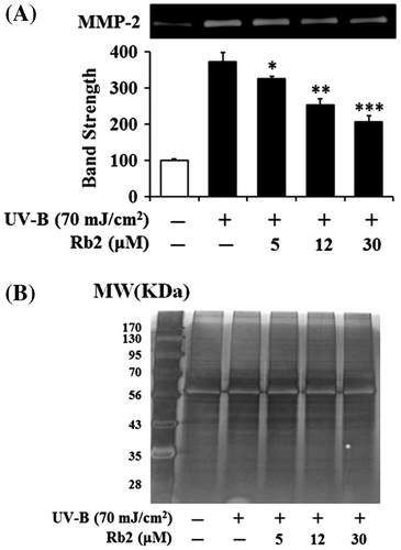 Fig. 3. Effect of Rb2 on MMP-2 activity in the conditioned media prepared from the human HaCaT keratinocytes under irradiation with 70 mJ/cm2 UV-B.Notes: (A) Mammalian cells were subjected to fresh media with the indicated concentrations (0, 5, 12, or 30 μM) of Rb2 for 30 min before the irradiation. The gelatinolytic activity of MMP-2 in the conditioned medium was detected using gelatin zymography. The relative band strength was determined with densitometry using the ImageJ software which can be downloaded from the NIH website. (B) The equal loading of conditioned media was shown by silver staining. *p < 0.05; **p < 0.01; ***p < 0.001 vs. the non-treated control (UV-B irradiation only).