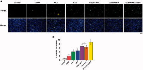 Figure 5. Combination of bevacizumab, apatinib and cisplatin increased apoptosis in mouse xenografts. (A) Representative images of TUNEL-stained (green) sections counterstained with DAPI (blue). Original magnification, ×200. (B) Percentage of TUNEL-positive cells in the pleural tumour nodules. ** p < .01 vs CDDP + APA + BEV. APA: apatinib; BEV: bevacizumab; CDDP: cisplatin; n.s.: not significant; TUNEL: terminal deoxynucleotidyl transferase dUTP nick end labelling.