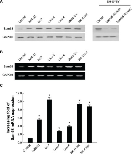 Figure 1 Upregulation of Sam68 protein and mRNA in neuroblastoma cell lines.