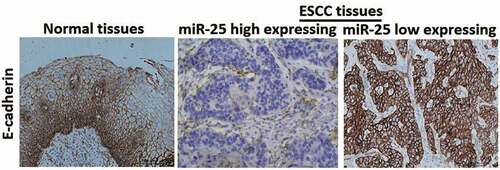 Figure 3. Immunohistochemical staining of E-cadherin.