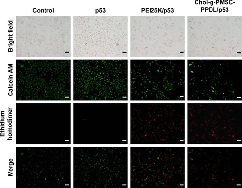 Figure 5 Live/dead staining of PC-3 cells after p53 gene transfection.Note: The scale bar is 100 µm.