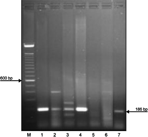 Figure 9.  Agarose gel electrophoresis of PCR products obtained from an organ mix (liver, spleen and cloacal swab material) from Birds 1 to 5 (lanes 1 to 5) of Farm 1. The pooled bile sample taken from Birds 1 to 3 was separated in lane 4. The RT-PCR product from the positive control (BLSV antigen, 187 base pairs) is in lane 7. M, DNA size marker, 100-base-pair (bp) ladder (Invitrogen GmbH, Lofer, Austria).