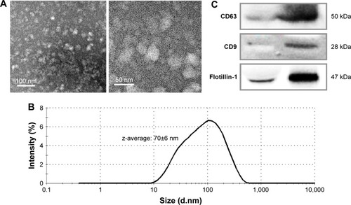 Figure 1 Characterization of the isolated exosomes by transmission electron microscopy (A), dynamic light scattering (B), and Western blotting for exosome-specific biomarkers (C).