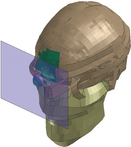 Figure 2 A biomechanical model of the head.