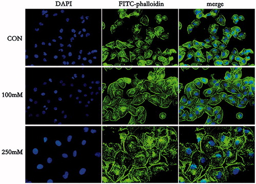 Figure 4. The cytoskeleton changes of HK-2 cells after treatment with mannitol for 48 h (×400). F-actin was visualized using FITC-phalloidin and cell nucleus was labeled by DAPI, respectively. Merged images of FITC-phalloidin and DAPI are also shown (merge).