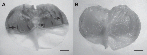 Figure 1.  Gastroprotective activity of Solidago chilensis aqueous extract. (A) Representative stomach of control group. (B) Representative stomach of group treated with 1200 mg/kg of extract. Arrows indicate some of the ulcers produced by ethanol. Bars = 5 mm.