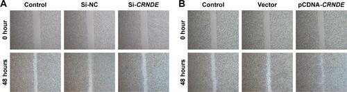 Figure S1 CRNDE was involved in cell migration of colorectal cancer cells. (A) Scratch-wound healing assay was used to assess the migration potency of SW480 cells after being transfected with CRNDE siRNAs or si-control control. The wound closure was calculated at 48 hours. (B) Scratch-wound healing assay was used to assess the migration potency of SW480 cells after being transfected with pcDNA-CRNDE or pcDNA-Vector. The wound closure was calculated at 48 hours.