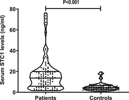 Figure 2 Scatter graph showing comparison of serum stanniocalcin-1 levels between controls and patients with severe traumatic brain injury. Serum stanniocalcin-1 levels were significantly lower in controls than in patients with severe traumatic brain injury (P<0.001).