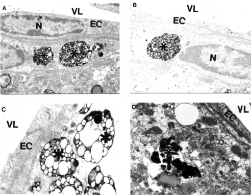 Figure 3 Features of APP immunostaining in frontal cortical microvessels in aged AβPP-YAC mice determined by PAP pre-embedding immunocytochemistry. A, B and C are without counter staining. D is with counter staining. Asterisks indicate amyloid deposition. Original magnification ×12,000.