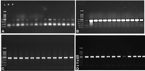 Figure 3 PCR products obtained from 48 F. hepatica adult worms isolated from cattle (A) Agarose gel electrophoretic analysis of PCR products of F. hepatica adult worms; L: 100 bp. Ladder, P: Positive control. N: negative control. The remaining lanes represent PCR products of F. hepatica adult worms at the size of 493 bp. (B), (C) and (D) showing the PCR products of Fasciola adult worms at 493 bp.