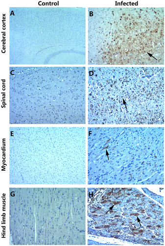 Fig. 4 Immunohistochemical staining of various tissues from the BALB/c neonatal mice following the intraperitoneal injection with CV-B5/JS417.a, c, e, g IHC staining of the cerebral cortex, spinal cord, myocardium, and hindlimb muscle in the control group, respectively. b, d, f, h IHC staining of the cerebral cortex, spinal cord, myocardium, and hindlimb muscle in the experimental group. Positive staining was detected in the cerebral cortex (b, arrow), spinal cord (d, arrow), myocardium (f, arrow) and hindlimb muscle (h, arrow) of the neonatal mice after the intraperitoneal injection of CV-B5/JS417. Magnifications ×40 (a); magnifications ×100 (b–h). n = 6–10 mice per group. One representative image is shown