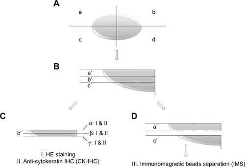 Figure 1 SLN prepared for different methods of intraoperative diagnosis.Notes: (A) The SLN was cut into four equal blocks and label them as blocks a, b, c, and d clockwise; (B) Each block was further trisected into sections a’, b’, and c’; (C) The section b’ of each block was frozen and stained with HE and CK-IHC, during which three layers (α, β, and γ) were sampled; (D) The sections a’ and c’ of each block underwent IMS.Abbreviations: SLN, sentinel lymph node; HE, hematoxylin and eosin; CK-IHC, cytokeratin immunohistochemistry; IMS, immunomagnetic separation; IHC, immunohistochemistry.