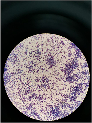 Figure 4 Result of pus culture showed Kocuria kristinae colony.