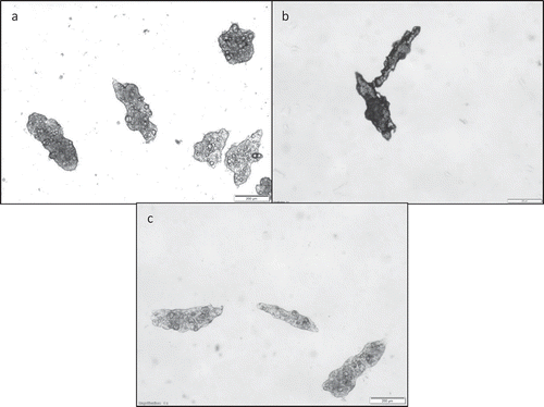 Figure 1. Optical micrographics (bar = 200 μm) of sample coded as 3G1A600 (3:1 g/100 g gelatin:alginate at 600 rpm) (a) after coacervation, (b) freeze-dried, and (c) rehydrated.