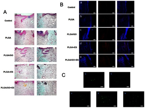 Figure 5 Differential effects of PLGA/GO composites and ES on tissue structure of wounds at 12 days. (A) Histological results. (a) Control, (b) PLGA biofilm, (c) PLGA/GO composites (2 wt%), (d) PLGA+ES, and (e) PLGA/GO composites (2 wt%) + ES. Magnification, 100×. Blue circle indicates subepidermal space, blue arrow indicates scar formation, yellow arrow indicates new capillary capillarie. (B) Immunofluorescence images of COL-1 levels in the wound-healing region at 12 days after different treatments. (a) Control, (b) PLGA biofilm, (c) PLGA/GO composites (2 wt%), and (d) PLGA+ES, and (e) PLGA/GO composites (2 wt%) + ES. Scale bars, 500 μm. (C) Immunohistochemical staining and quantification of CD31-positive microvessels in the wound-healing region at 12 days after different treatments. (a) Control, (b) PLGA, (c) PLGA/GO composites (2 wt%), and (d) PLGA+ES, and (e) PLGA/GO composites (2 wt%) + ES. Scale bars, 100 μm.