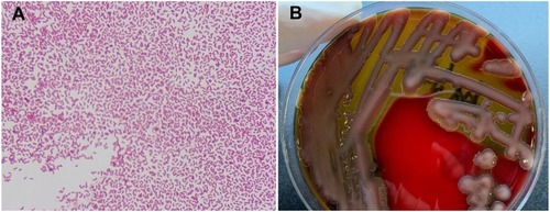 Figure 1 (A) Gram stain showing Gram-negative curved bacilli (×1000). (B) Blood agar showing β-hemolytic colonies.