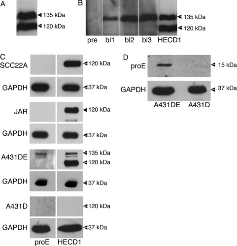Figure 1.  Expression of immature E-cadherin in A431DE cells. (A) Fifty microgram of protein from TNE extracts of A431D cells transfected to overexpress E-cadherin (A431DEplasmid) was resolved by 7% SDS-PAGE and immunoblotted with the HECD1 monoclonal anti-E-cadherin antibody. The 135-kDa proregion containing E-cadherin and the 120-kDa mature E-cadherin are pointed out. (B). Fifty microgram of protein from TNE extracts of A431DEplasmid cells was resolved by 7% SDS-PAGE and immunoblotted with preimmune serum (pre) and successive bleeds (bl1, bl2, bl3) from a rabbit immunized with E-cadherin proregion peptide. Lane 5 shows an immunoblot of the same extract using HECD1 to point out mature (120-kDa) and immature (135-kDa) E-cadherin. (C) Fifty microgram of protein from TNE extracts of SCC22A cells, JAR cells, A431DE cells (infected to express physiological levels of E-cadherin), and A431D cells were resolved by 7% SDS-PAGE and immunoblotted with anti-proE-cadherin antiserum or HECD1 monoclonal anti-E-cadherin antibody. GAPDH was used as a loading control. (D) Lysates from A431DE and A431D cells were resolved by 15% SDS-PAGE and immunoblotted using anti-pro-E-cadherin antiserum. GAPDH was used as a loading control.