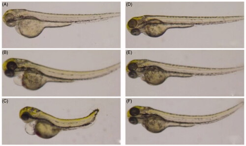 Figure 3. The effect of volatile oil of C. phaeocaulis and its vinegar-processed products on zebrafish heart morphology. (A) Blank control group. (B) Volatile oil of C. phaeocaulis (20 µg/mL). (C) Volatile oil of C. phaeocaulis (50 µg/mL). (D) Blank control group. (E) Volatile oil of C. phaeocaulis vinegar-processed products (20 µg/mL). (F) Volatile oil of C. phaeocaulis vinegar-processed products (50 µg/mL).