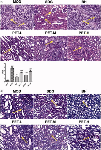 Figure 2. Pathological changes in renal tissue: (A) Representative images of HE staining (×200) and score; (B) Representative images of Masson staining (×200). Values represent the mean ± SD. *p < 0.05 and **p < 0.01 compared to the model group. #p < 0.05 and ##p < 0.01 compared to the sham group.