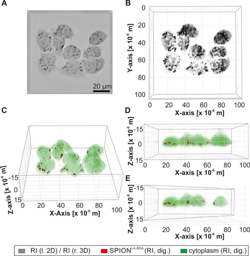 Figure 2 Live-cell-holotomography of cellular nanoparticles. PANC-1SMAD4 (2−6) cells with unlabeled SPIONLA-BSA are visualized by differences in the refractive index. (A) The 2D image shows an X-Y slice of the RI image. (B–E) The 3D RI images represents the same sample under different angles. (C–E) In the 3D RI images, structures with low RI, such as cytoplasm, cell nuclei and nucleoli, were digitally stained in green, whereas structures with high RI, such as SPION clusters, were digitally stained in red. (b-e) Exemplary RI Images with different viewing angles (B) 90° (C) 45° (D) 0° (E) 0° and diagonally cut through the Y-axis).