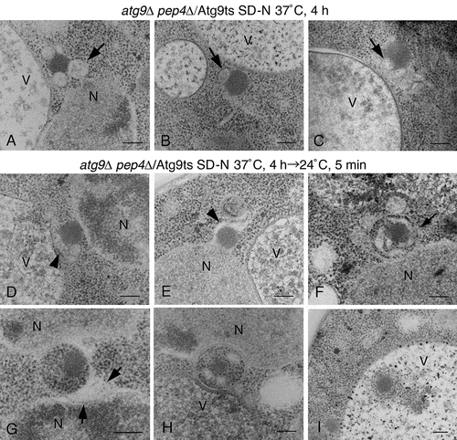 Figure 7. The detection of the alphasome and autophagosome in atg9∆ pep4∆ cells expressing Atg9ts. (A to C) Cells were grown in SD selective media to mid-log phase at permissive temperature (24°C), and then shifted to SD-N medium at 37°C for 4 h. (D to I). After the shift up to 37°C in SD-N medium for 4 h, the cells were shifted down to 24°C in SD-N medium for 5 min. The arrows (A to C) point to alphasomes. The arrowheads (D and E) show the elongated membrane sac. The arrows (F and G) point to the lumen of an autophagosome. Scale bars: 200 nm. N, nucleus; V, vacuole.