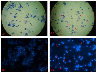 Figure 1 The result of the micronucleus test of magnetic nanoparticles Fe3O4- MNPs/DNR.Notes: A1) normal bone marrow of mice observed by optical microscope (Giemsa staining, 10 × 100); B1) normal bone marrow of mice observed by optical microscope (DAPI staining, 10 × 100); A2) formation of micronucleus observed through fluorescence microscope (Giemsa staining, 10 × 100); B2) formation of micronucleus observed through fluorescence microscope (DAPI staining, 10 × 100) (Formation of micronucleus are indicated by “→”).Abbreviations: Fe3O4-MNPs, magnetic Fe3O4 nanoparticles; DNR, daunorubicin; DAPI, 4,6-diamidino-2-phenylindole.
