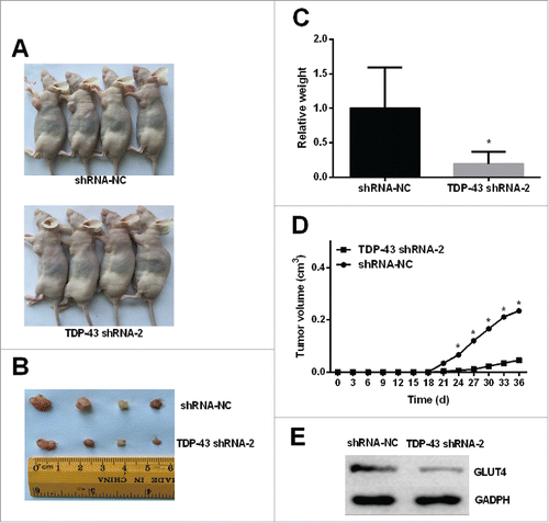 Figure 5. TDP-43 depletion affects tumorigenicity of A375 cell line and GLUT4 expression in vivo. Nonsilencing shRNA-transfected A375 cells and TDP-43 shRNA-2-transfected A375 cells with transfection efficiency greater than 80% were inoculated to right axillary fossa of each nude mice. (A-B) Tumor tissues isolated from indicated mice at day 35 post-transplant. (C-D) TDP-43 shRNA-2 significantly decreased the tumor weights and volumes. (E) Western Blot showed decreased GLUT4 expression in TDP-43-knockdown melanoma tumors. *P < 0.05.