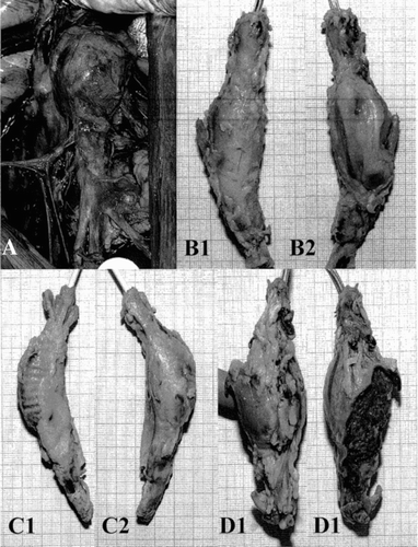 Figure 13 Gross observation of the specimens at the sacrifice of the animals: A) encapsulated prosthetic aneurysm fitted with a stent-graft before explantation; B1, B2) encapsulated prosthetic aneurysm representation of the 19 specimens whose encapsulations was classified as excellent; C1, C2) representative specimen of the 6 devices well encapsulated although the polyester graft of the prosthetic aneurysm was visible through the translucide fibrous tissues; D1, D2) representative specimen of the 4 devices whose external capsule was ulcerated.