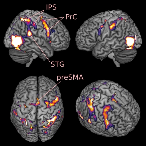 Figure 1. Parietal and premotor cortices are active during the observation of hand actions. IPS, Intraparietal sulcus; PrC, Precentral gyrus/sulcus; preSMA, pre-supplemetary motor area; STG, superior temporal gyrus. Results are from a random effect analysis of the functional images of 17 participants (P<0.0005 FWE corrected; F3,48 = 20.34). The most anterior part of the IPS cluster extends to Brodmann area 2 (in the anterior IPS aka post-central sulcus), the highest level of processing in the primary somato-sensory cortex.