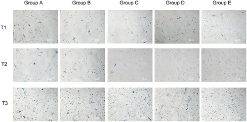 Figure 3. Comparison of ratio of senescent cells at different time. Note: T1: Ratio of senescent cells of different groups before surgery; T2: Ratio of senescent cells of different groups 6 h after surgery; T3: Ratio of senescent cells of different groups 24 h after surgery; Group A: No treatment was taken after the rabbits were anaesthesia; Group B: After the rabbits were anaesthesia, the left lateral lobe of the liver was surgically resected under open abdomen, and the blood volume was supplemented by infusion of sodium lactate Ringer's solution without transfusion; Group C: 10% of rabbit whole blood was collected and stored one week before surgery. Then the left lateral lobe of liver was surgically removed, and the blood volume was supplemented by infusion of sodium lactate Ringer's solution without transfusion; Group D: 10% of rabbit whole blood was collected and stored one week before surgery. The left lateral lobe of liver was surgically removed, and the stored autologous whole blood was transfused back during the operation; Group E: 10% of rabbit whole blood was collected one week before surgery and made into suspended red blood cells for storage. One week later, the left lateral lobe of the liver was surgically removed and the stored autored blood cells were transfused back during the operation.