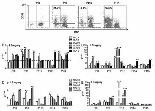 Figure 6. Tumor infiltrating NK cell activity was influenced by the expression of activating or inhibiting NK ligands and receptors. (A) Dot plots showing the percentage of NK cells infiltrating tumor mass of four patients as evaluated by flow cytometry. (B-E) Bar graphs showing the relative expression of activating (MICA, MICB, ULBP1-3) or inhibiting (HLA-E) ligands and receptors (NKp30, NKp44, NKp46, NKp80, NKG2D) in specimens from first and second surgery of five patients (four non-responders – Pts 8, 10, 14, 15 – and one responder – Pt9), evaluated by real time PCR. The relative expression of ligands and receptors was compared with that detected in normal brain tissue (dotted line).