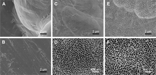 Figure 2 SEM images showing the surface topography of samples (scale bar of A–C, E =2 µm, scale bar of D, F =400 nm).Notes: (A) SLM sample with unmelted titanium particles and spheres on the rough waving surface; (B) MP sample with flat surface; (C, D) different magnifications of AO sample showing the arranged TiO2 nanotubes; (E, F) different magnifications of AOC sample showing the amorphous nanoparticles embedded in the nanotubes or the interval of nanotubes.Abbreviations: SEM, scanning electron microscopy; SLM, selective laser melting; MP, mechanically polished; AO, anodic oxidation; AOC, anodic oxidation composited with electrochemical deposition.