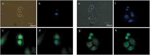 Figure 2. Cellular distribution of choline at the mitotic exit. HeLa cells, synchronized by 2TB (a–d) or nocodazole (e–h), were incubated with 2 mM prop-Cho in complete media for 2 h (G2/M to G1 transition). The cells were fixed and reacted with 10 µM azide-Alexa488 (c and g). After counterstaining with Hoechst (b and f), the cells were imaged by fluorescence microscopy and phase contrast at 100X in an Olympus BX51 microscope. (a) and (e), bright field; (d) and (h), merged.