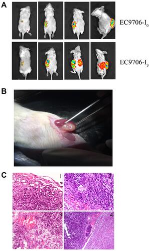 Figure 4 Subrenal capsule xenograft tumor model. (A) Live animal imaging for assessing tumourigenicity and tumor growth of EC9706-I0 and EC9706-I3 cells at weeks 3, 8, and 14 post-operation. (B) Tumor specimen of EC9706-I3 xenograft tumors at day 17 post-operation. (C) Tumor metastasis in the subrenal capsule model using EC9706-I3 cells: 1) tumor cells grown under the renal capsule and gradually invaded into the renal tissue; 2) tumor cells gradually invaded and wrapped around glomerulus and renal tubules; 3) tumor cells gradually approached the renal vessels and invaded the vascular system; 4) tumor cells invaded the vascular system, survived and stayed, formed tumor thrombus, and metastasized to other organs by blood vessels.