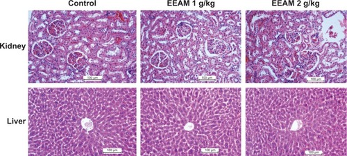 Figure 2 Histopathology analysis (H&E staining, 20×) of kidney and liver from control, EEAM at 1 g/kg, and EEAM at 2 g/kg demonstrated no significant differences in the structures of kidney and liver between vehicle control and EEAM-treated groups.
