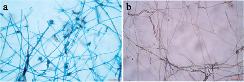 Figure 4. Long, straight and septate conidiophores and catenate conidia. (a) lactophenol cotton blue stain, 400× magnification. (b) 10% KOH stain, 400× magnification.