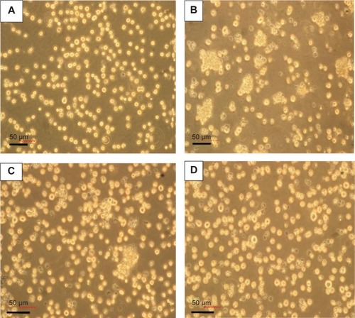 Figure 11 Optical micrograph of HL-60 cells cultured for 72 hours (×100) with (A) fresh medium (control); (B) 5 μg/mL Ara-C; (C) 5 μg/mL ABMs-P; and (D) 5 μg/mL BMs.Abbreviations: ABMs-P, cytosine arabinoside-loaded genipin-poly-l-glutamic acid-modified bacterial magnetosomes; Ara-C, cytosine arabinoside; BMs, bacterial magnetosomes.