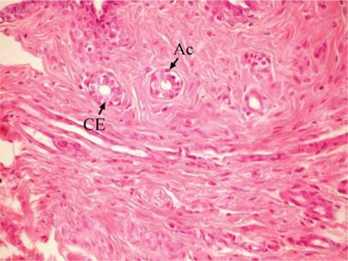 Figure 2 Photomicrograph of breast section of normal control rat showing normal acini (Ac) lined with CEs (H and E, ×400).