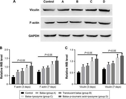 Figure 13 WB was used to detect changes in the vinculin and F-actin at 3 and 7 days.Notes: (A) WB results at day 7; (B) WB results for F-actin; (C) WB results for vinculin.Abbreviation: WB, Western blot.