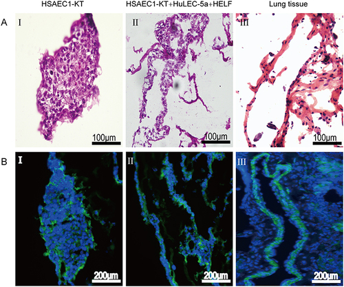 Figure 3 The morphology and structure of 3D cultured cells and normal lung tissues were observed by H&E staining and phalloidin staining. (A) H&E staining. (B) Phalloidin staining (A-I and B-I). Gel‑cell clumps of HSAEC1-KT cells in RADA16‑I were harvested on day 14 and then stained by frozen sectioning. The cells were clustered into dense cell masses without tubular structure (A-II and B-II). Gel‑cell clumps of HSAEC1-KT, HuLEC-5a and HELF cocultured in RADA16-I at a ratio of 10:7:2 were harvested on day 14 and then stained by frozen sectioning. The cells self-assembled into a hollow tubular structure, and a large number of cells were arranged and distributed around the lumen (A-III and B-III). Human normal lung tissues were stained as frozen sections. The structure of the airway lumen was observed, and a large number of cells were arranged and distributed around the lumen. Green indicates F‑actin, and blue indicates DAPI‑stained cell nuclei.