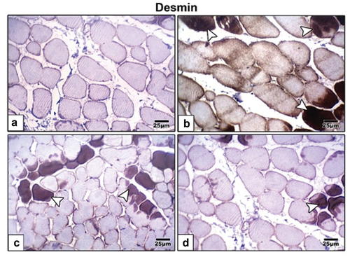 Figure 6. Photomicrographs of formalin fixed histological sections of tibialis muscle fibers immunohistochemical stained with desmin of 21-day-old rat. (a) Control showing weak reaction of desmin. (b) High fat diet showing increased dark brown reaction of desmin in muscle fibers indicating cell death. High fat diet treated with (c) barley and (d) fenugreek supplementation showing decreased immunohistochemical reaction of desmin. Arrow head indicating desmin immunohistochemical reaction.