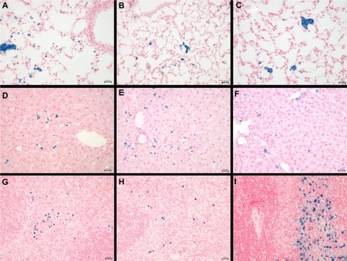Figure 7 Distribution of iron after injection of SPION microbubbles in rat lungs, liver, and spleen at various time points visualized by Perl’s Prussian blue staining. SPION microbubbles/iron at 10 minutes, one week, and 6 weeks post injection in (A–C) the lungs, (D–F) liver, and (G–I) spleen. The size bar represents 25 μm.Abbreviation: SPION, superparamagnetic iron oxide.